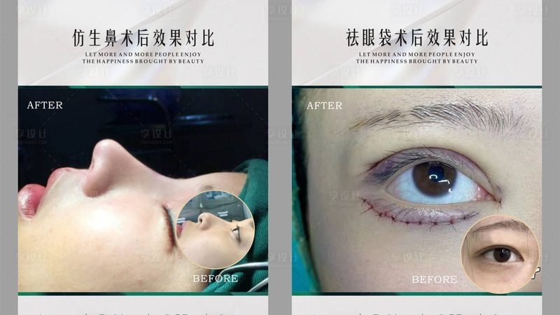 以下为肉毒素注射后的注意事项图片，供您参考：