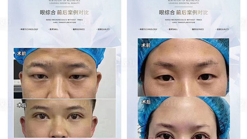 家用瘦脸按摩仪，真能瘦双下巴吗？**