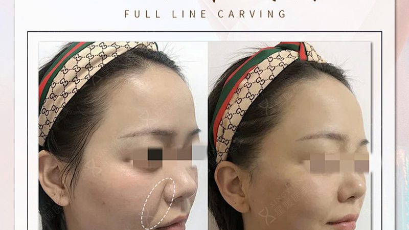 注射美容操作规范流程视频