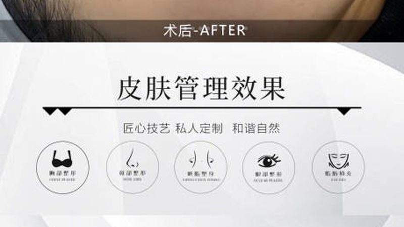 超声炮，揭秘其背后的技术秘密与选型要点**