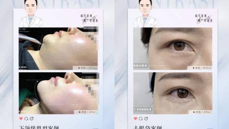 大分子玻尿酸VS小分子玻尿酸：作用区别揭秘