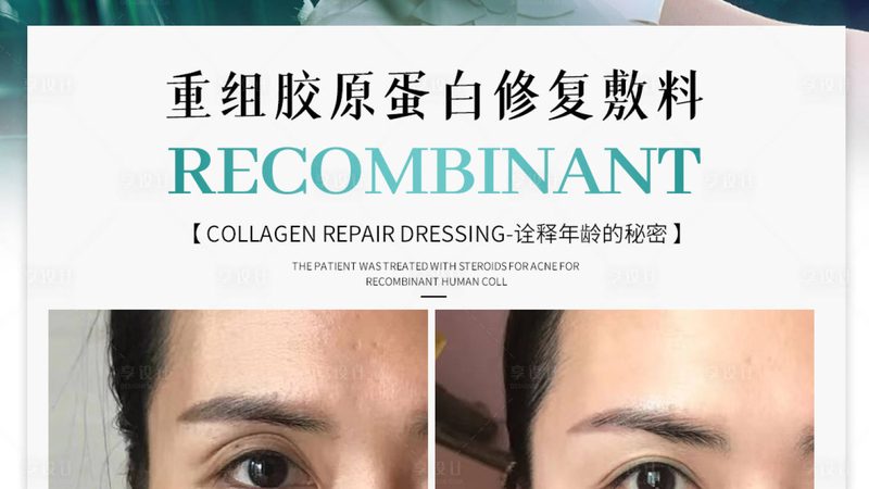 膨体隆鼻与硅胶隆鼻：价格背后的差异解析