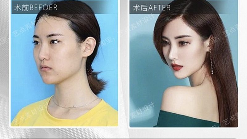 医美抗衰，揭秘最有效的三大技术