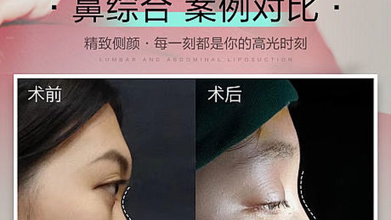 揭秘上海医美医院口碑评价背后的真相