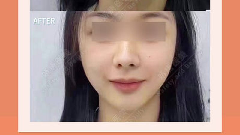 揭秘皮肤管理店装修：价格构成与影响因素