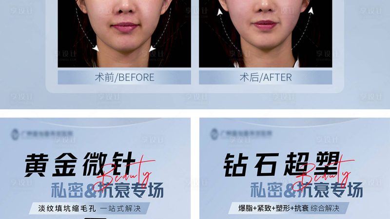 上海激光脱毛价格差三倍，到底差在哪