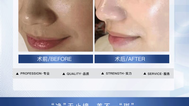 家用超声炮：使用前的五大注意事项**