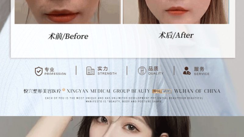 水光针VS玻尿酸：揭秘两者差异，美丽从了解开始