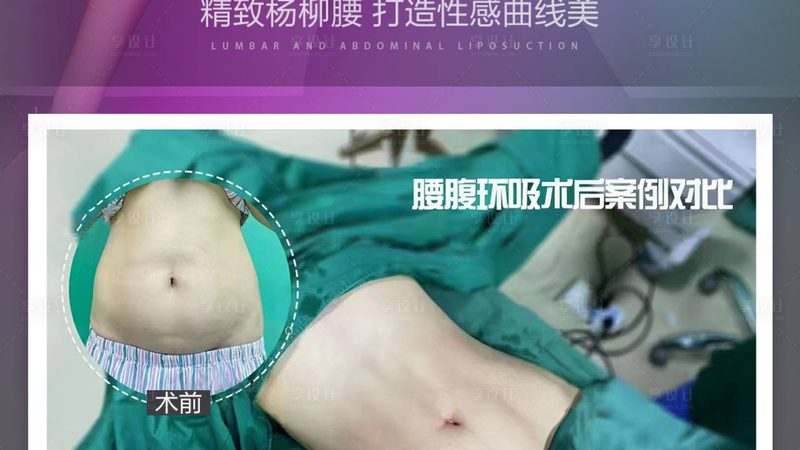 玻尿酸耗材批发价格：揭秘背后的因素与选择要点