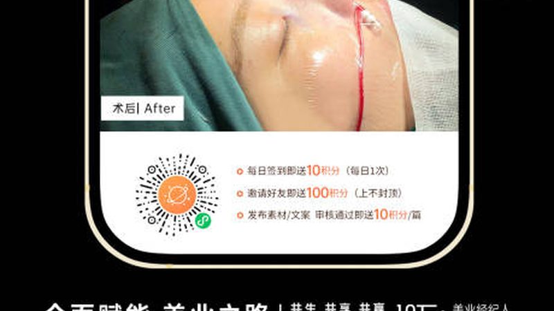 学生打瘦肩针肉毒素价格