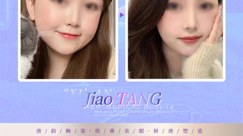 超声炮：揭秘其技术原理与市场现状**