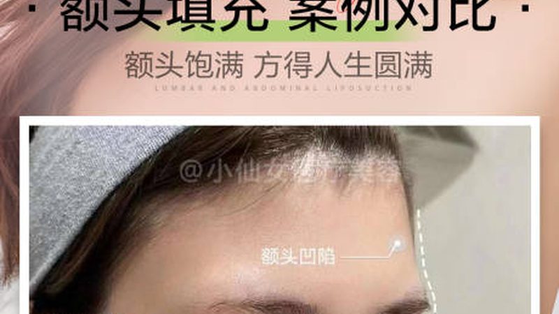 小标题：选择隆鼻医院，关注这些关键点