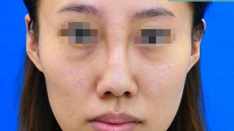 医美咨询师流程培训：揭秘专业之路
